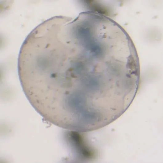 Microscopic view of a Sand Lance Egg from Lillian Hoffar Beach